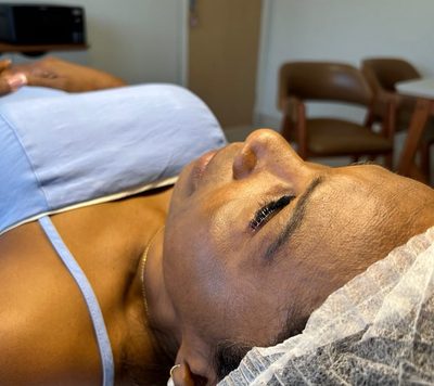 Antes do tratamento: Limpeza de pele, registro feito logo após a sessão. Poros desobstruídos e pele preparada para absorver melhor o skincare.